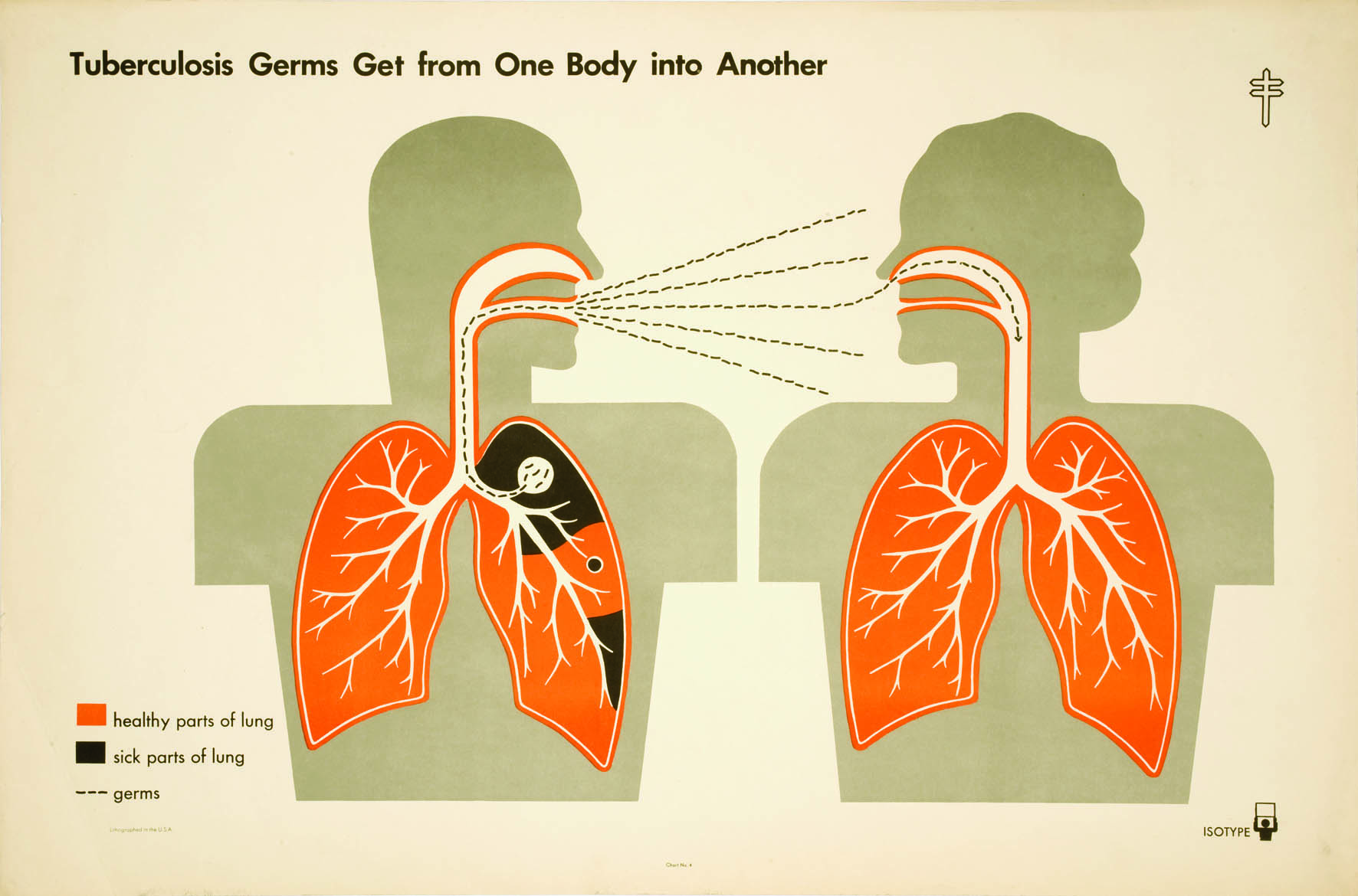 tuberculosis